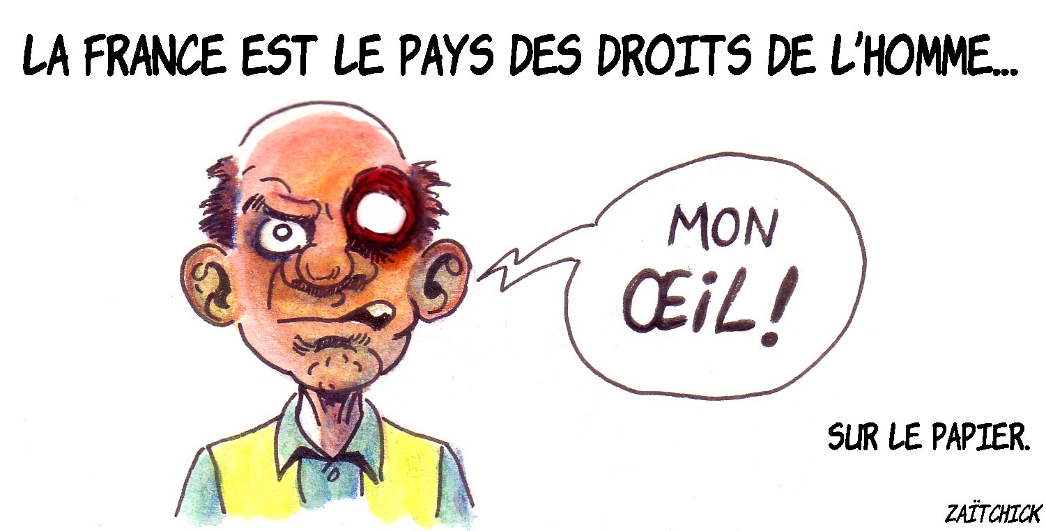 ça crève les yeux !