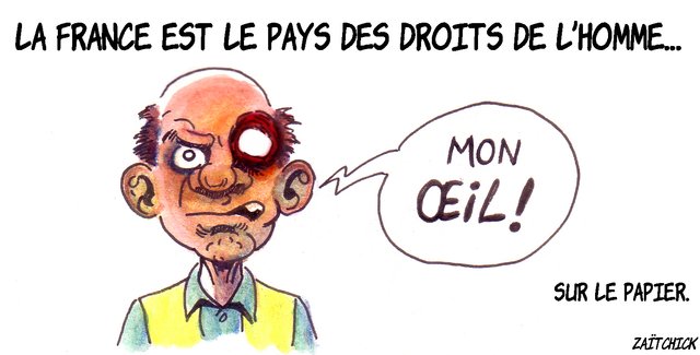 ça crève les yeux !